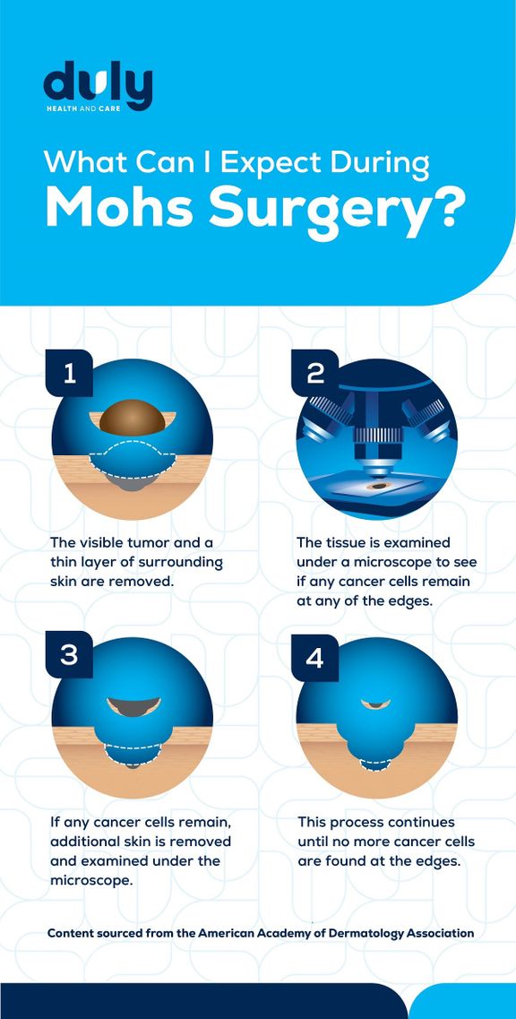 What Can I Expect During Mohs Skin Cancer Surgery?